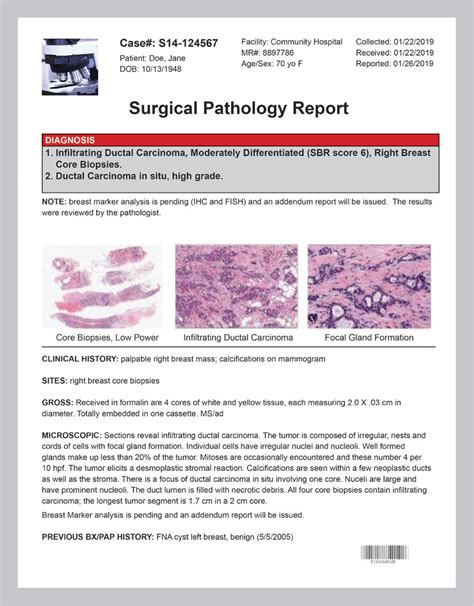 pathology report for melanoma